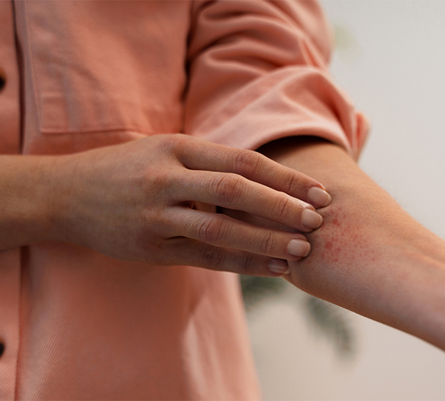 An adult in a coral-colored blouse scratches left forearm that has a rash on it