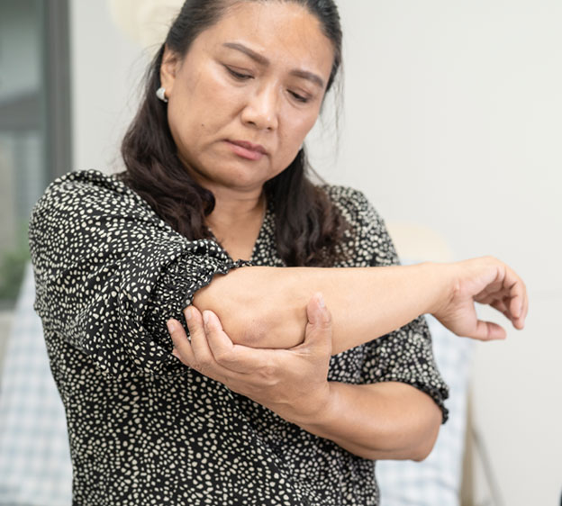 Middle-age woman holding her elbow as though it hurts