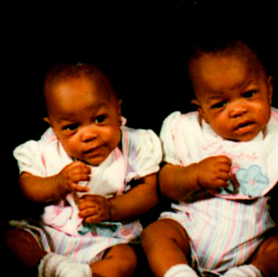 A baby picture of the Lundy twins