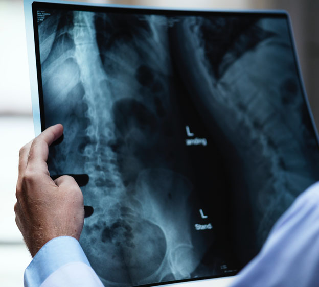 physician examining an x-ray