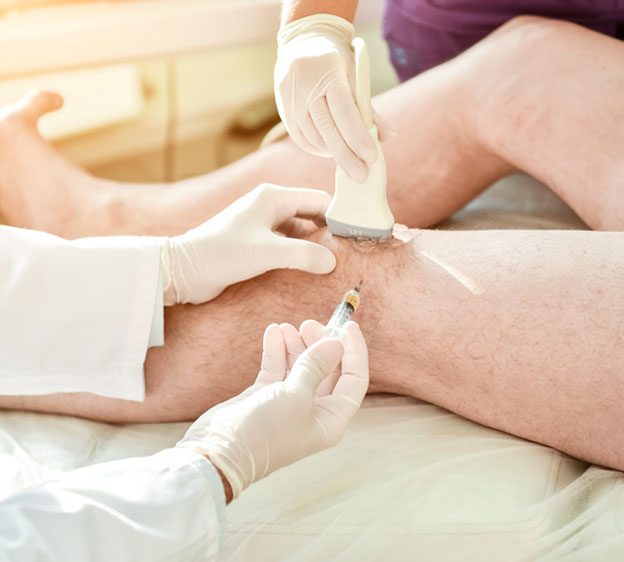 What You Need to Know About Cortisone Injections