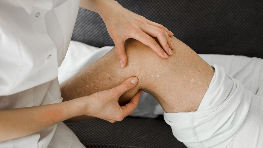 provider examining a patient's leg veins